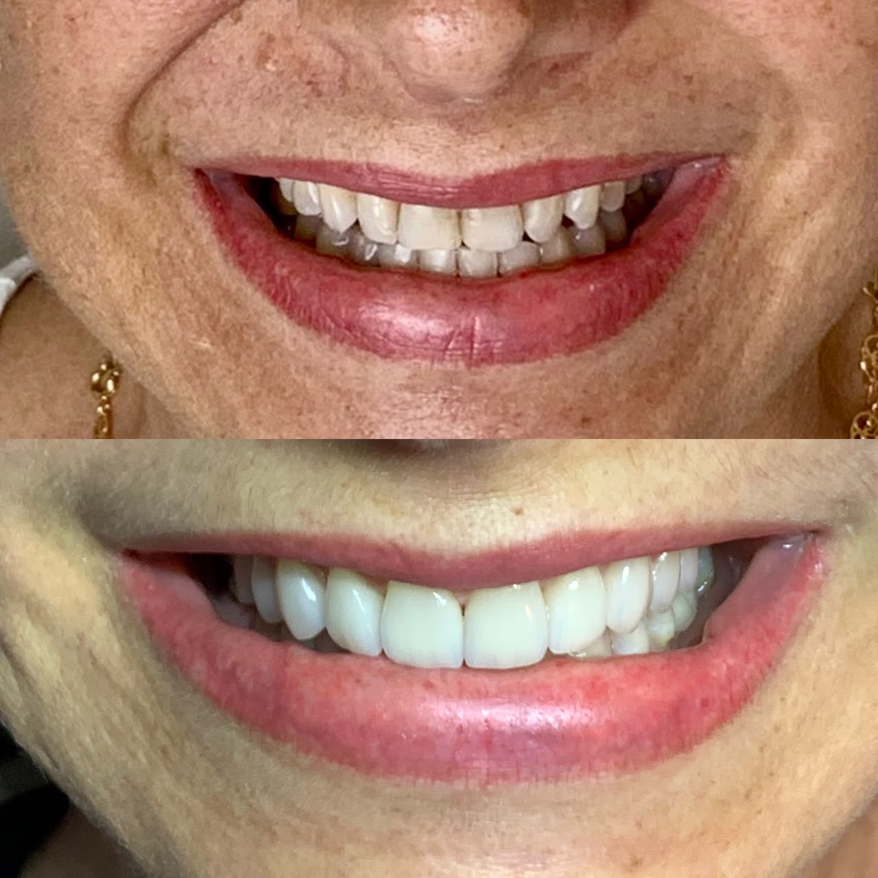 Caso antes e depois 7
