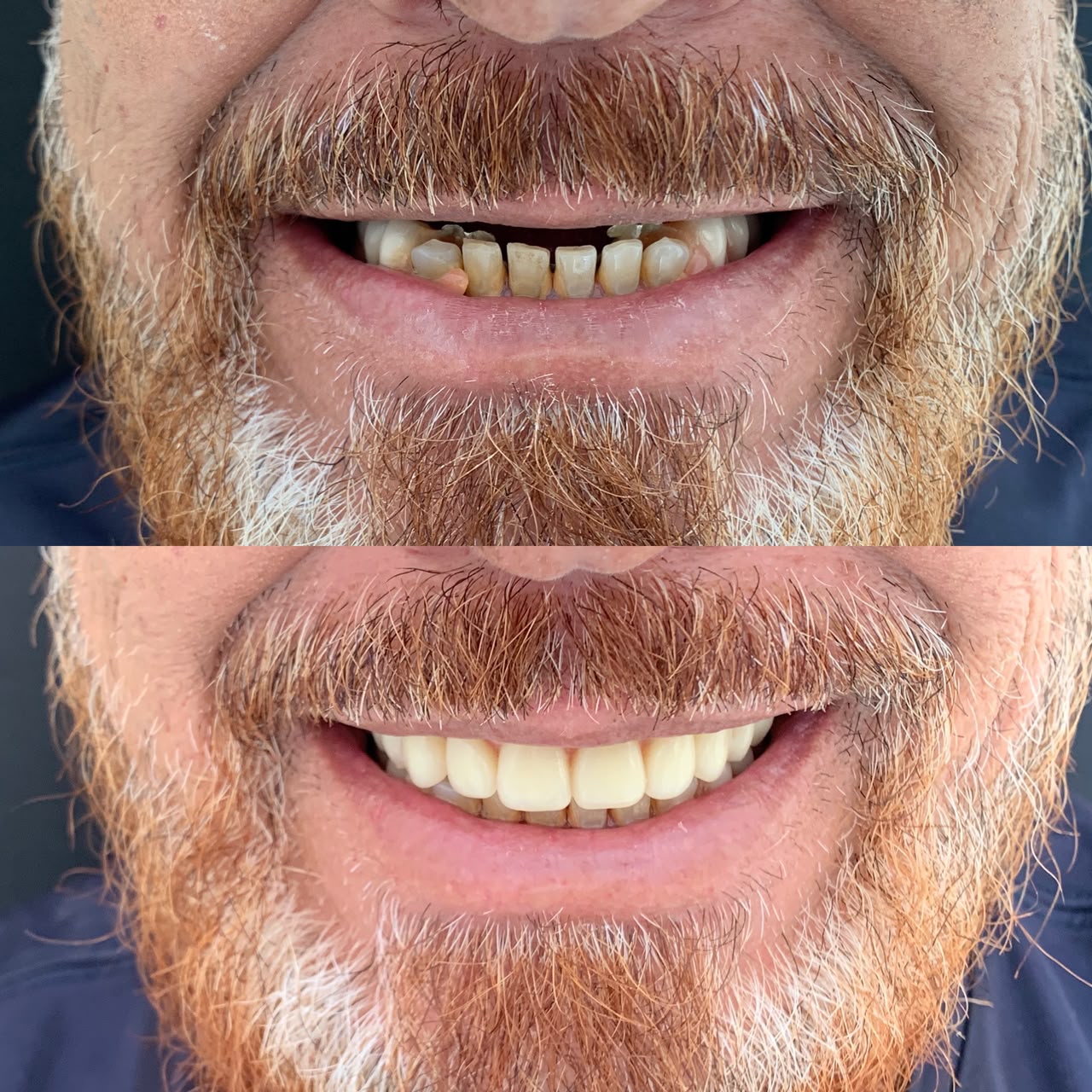 Caso antes e depois 8